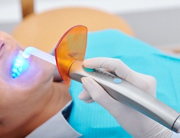 A dentist uses a curing light to harden composite resin into place on a male patient’s smile